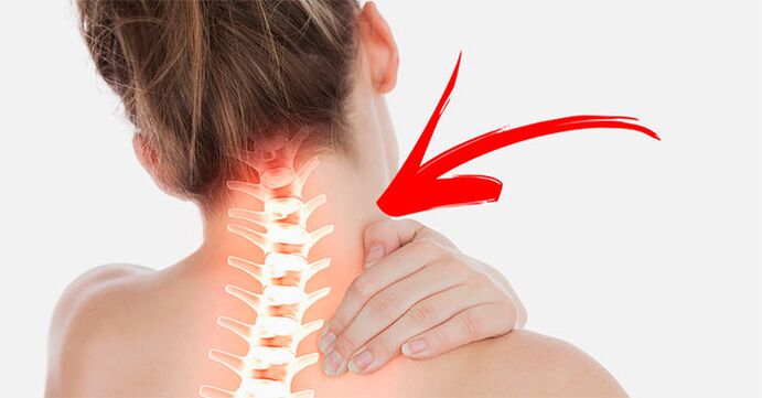 ból szyi dlaczego i co robić